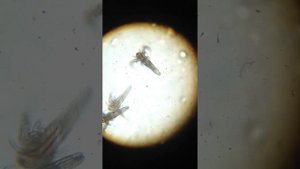 Бактерии под микроскопом 1