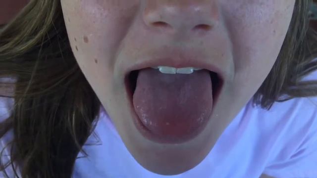 My Tongue 2.5 Weeks Since Meds смотреть онлайн