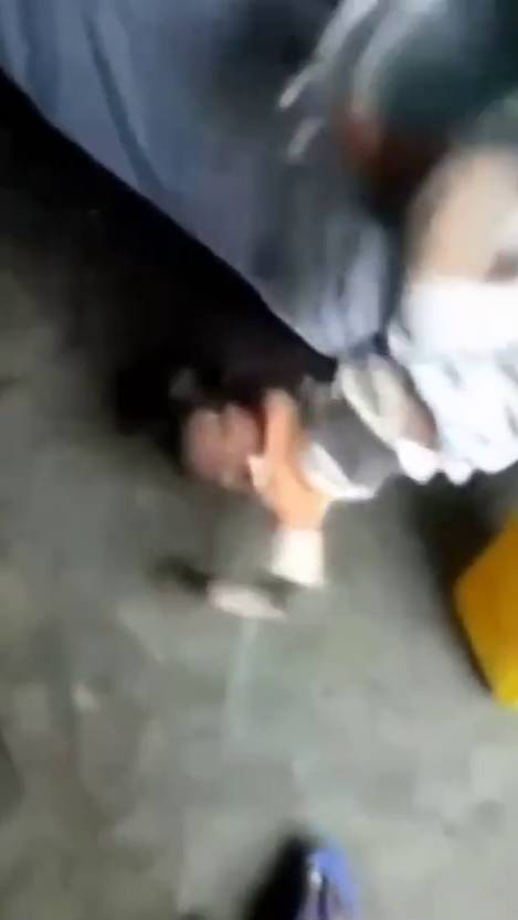 Негритёнок крутил брейк и опрокинул на себя горячий суп смотреть онлайн