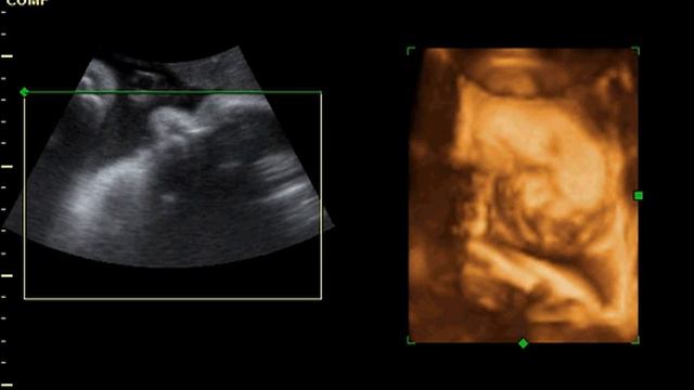 3D/4D Real Time Movie, week 36 смотреть онлайн