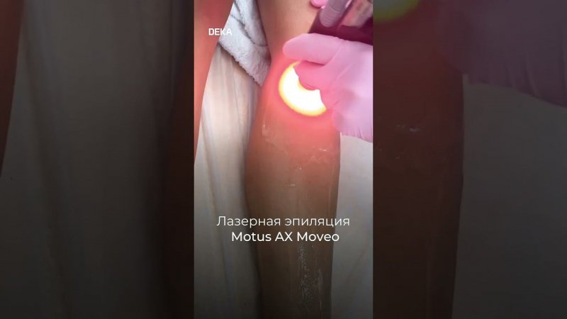 ЛЮБОЙ ФОТОТИП - НЕ ПРОБЛЕМА ДЛЯ MOTUS AX С ТЕХНОЛОГИЕЙ MOVEO