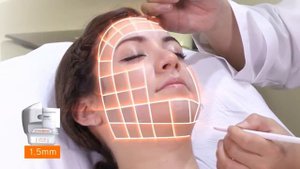 Ultraformer