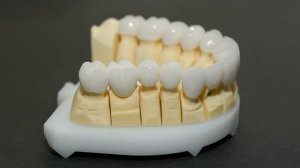 Коронки из диоксида циркония