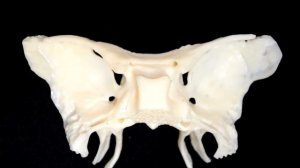 Клиновидная кость