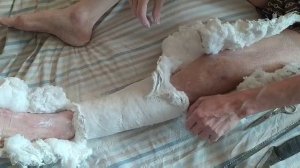 Снятие гипса самостоятельно подручными средствами. "К врачу - не хочу!" Часть 1