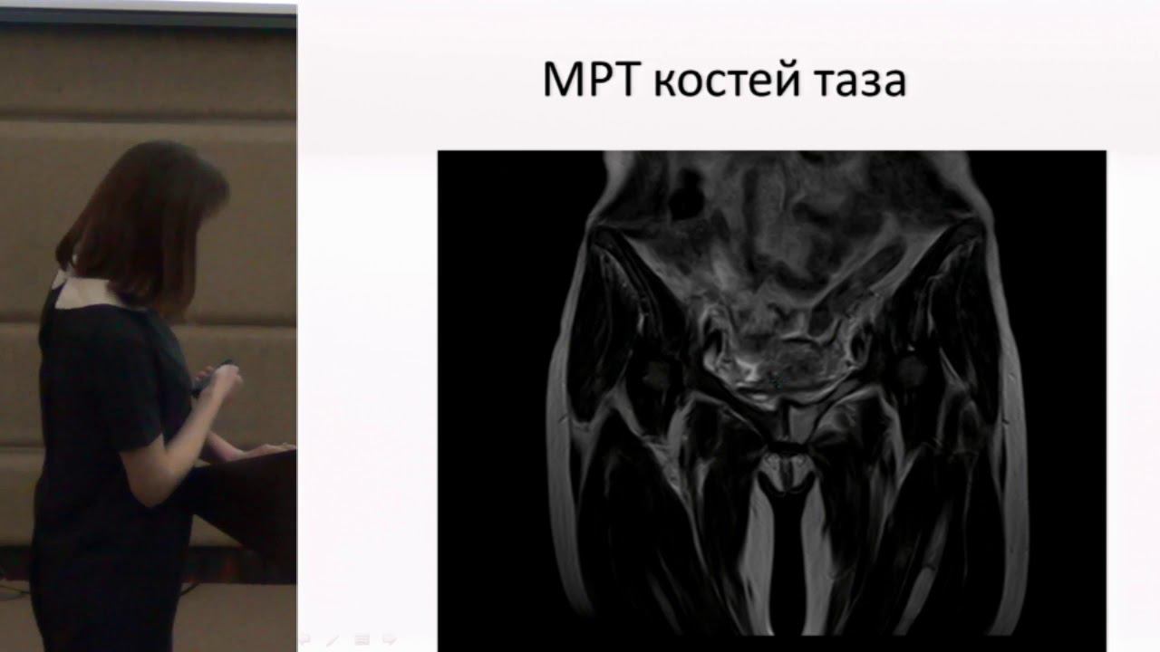 Круглова М.В. Случай системной красной волчанки с трагическим исходом | Системная красная волчанка