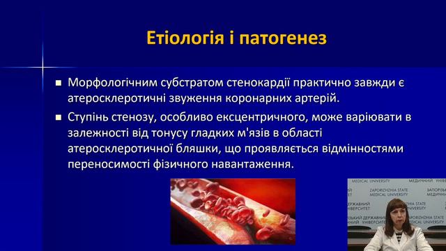 Ведення хворих на ІХС в амбулаторній практиці смотреть онлайн