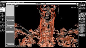 Обучающее видео «Сосуды головы»