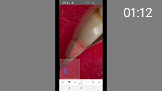 Отбеливание зубов с помощью Snapseed. Портфолио мастера перманентного макияжа