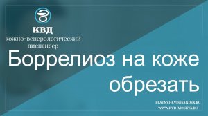 342  Боррелиоз на коже обрезать