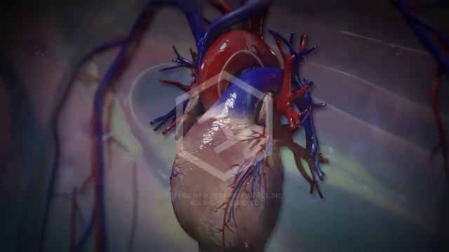 Stent Procedure смотреть онлайн