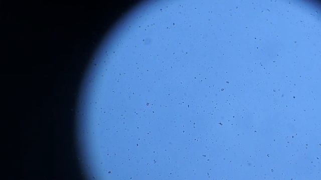 Микрофлора лужи. Одноклеточные обитатели лужи после дождя. смотреть онлайн