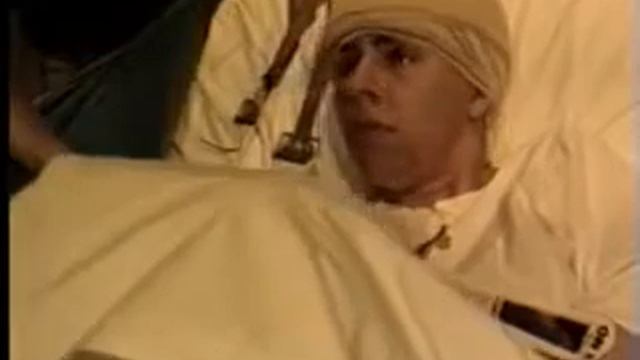 Вторично генерализованный судорожный приступ