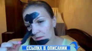 Удаление Гноя Из Пор Носа [Точки На Носу]