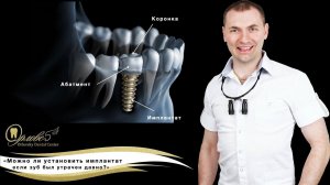 Прямой эфир на тему "Можно ли установить имплантат если зуб был утрачен давно" (Орловский Е.А)