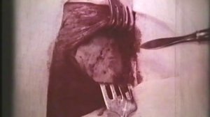Декомпрессионная трепанация черепа по Кушингу © Decompression craniotomy for Cushing
