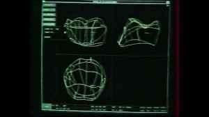 Цифровая стоматология для чайников. 1 серия.