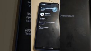 Настройка графика сахаров на MiBand7, AmazFit на zeppOS