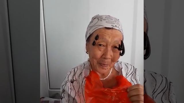 Гб 3ст.Варикоз нижних конечностей