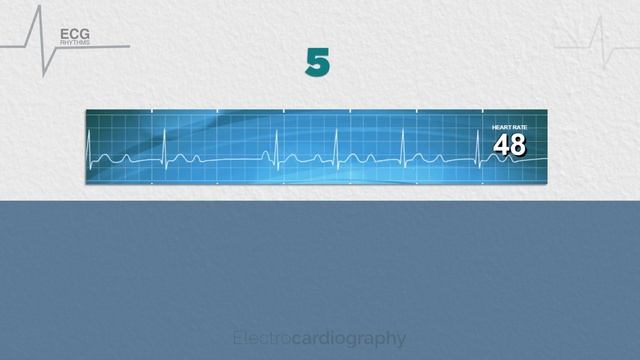 ECG Rhythms for self-assessment: Test ECG Interpretation Skills смотреть онлайн