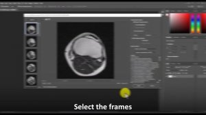 How to View a DCM File (How to Open DCM Files)
