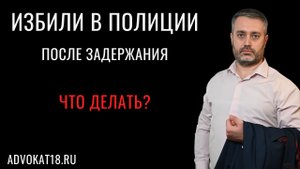 Избили полицейские и поместили в ИВС - что делать и как реагировать? Избиение после задержания