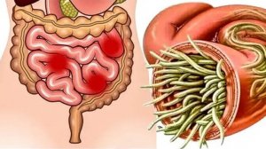 Как паразиты пожирают вас изнутри - Интересные факты о жизни паразитических плоских червях!