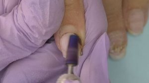 Позеленел Ноготь под Покрытием ? Это что, плесень? ? Или грибок? Как исправить и причины появления