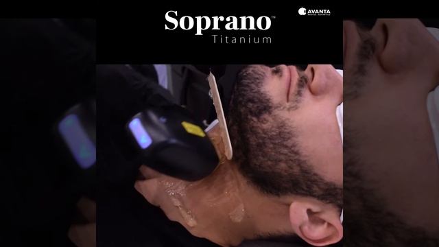 Soprano Titanium դիոդային լազերային մազահեռացում смотреть онлайн