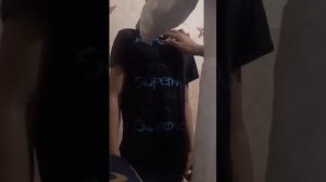 Пальпация эндокринных желез и щитовидной железы.