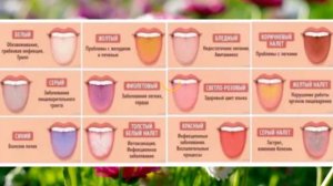 Как определить ПРОБЛЕМЫ со здоровьем по ЦВЕТУ ЯЗЫКА! Посмотрите на него в зеркало!