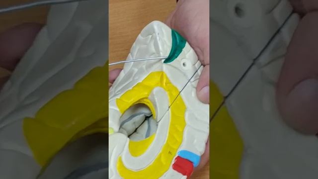 Медиальная и латеральная поверхности больших полушарий.