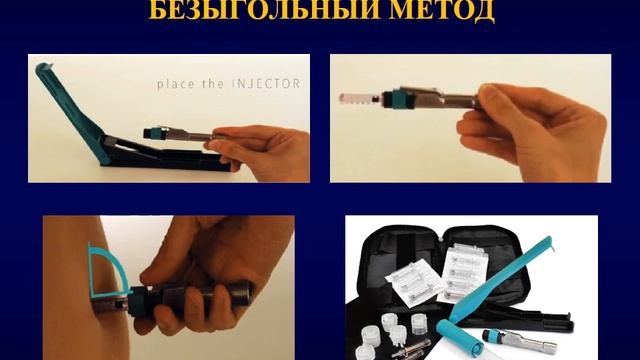 Принципы анестезиологии в детской стоматологии