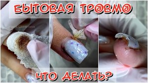 Бытовая травма ? - что делать?