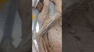 Анатомия мышцы верхней конечности