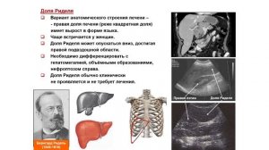 Ультразвуковая диагностика (УЗИ). Доктор Иогансен. Выпуск 8. Методика УЗИ печени.