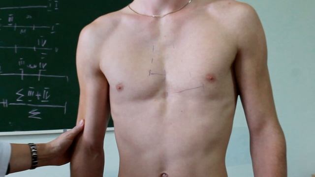 Перкуссия сердца смотреть онлайн