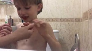 Удаление молочного зуба.