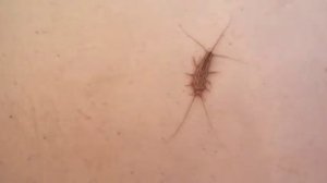 Вид мокрицы