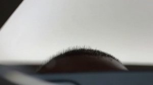 Как правильно стричь волосы после пересадки волос? / Красавчик