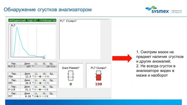 3 метода для точного подсчёта тромбоцитов или забудьте про Фонио навсегда!