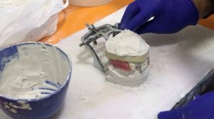 Гипсовка окклюдатора