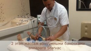 Вакуумно-роликовый массаж Старвак (Starvac)