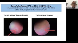 Diagnostic Imaging In Pediatric Urology & Antenatal Hydronephrosis, by Kurniawan Oki Pamungkas