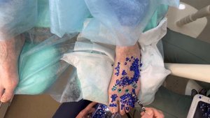 Дистрофия / Лечение ногтей / Тренд ДОДЖИ КЭТ и ГОАР АВЕТИСЯН #ногти #тренд #грибокногтей #дистрофия