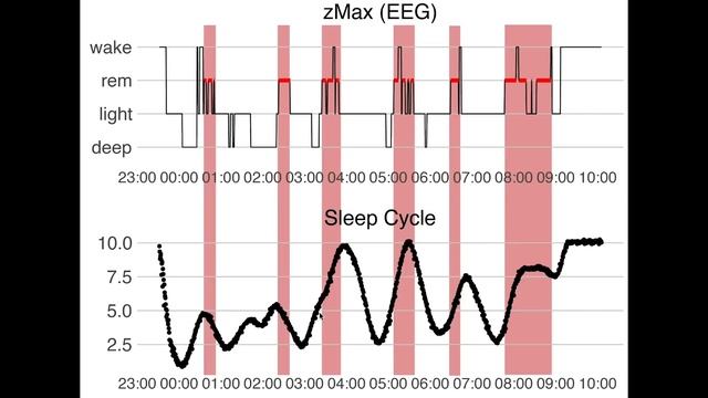 Sleep Cycle App Review: Apple Watch Science Test смотреть онлайн