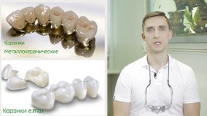 Керамические реставрация зубов. ? Плюсы керамических реставраций зубов. Алена.