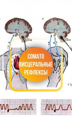 Сомато-висцеральные рефлексы - это то, что мы используем при работе с пациентом