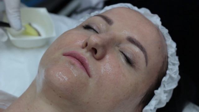 Процедура холодная плазма "Beauty monster"