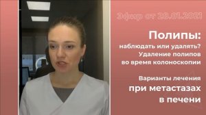 Полипы: удалять или наблюдать?
Варианты лечения при метастазах в печени